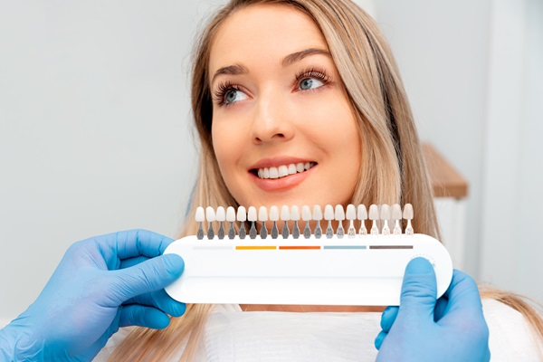 How Long Do Veneers Last? Tips For Maintaining Your New Smile