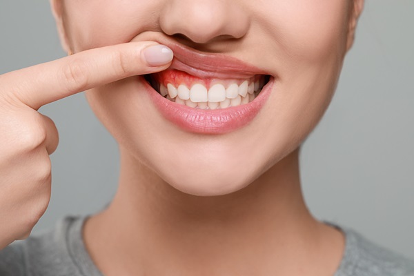 The Most Common Types Of Gum Disease